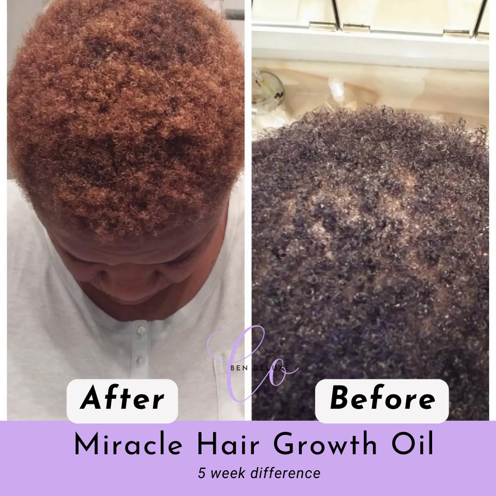 'Raw' African Indian Infused Growth oil 💜 VIRAL + BEST SELLER🔥