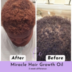 'Raw' African Indian Infused Growth oil 💜 VIRAL + BEST SELLER🔥