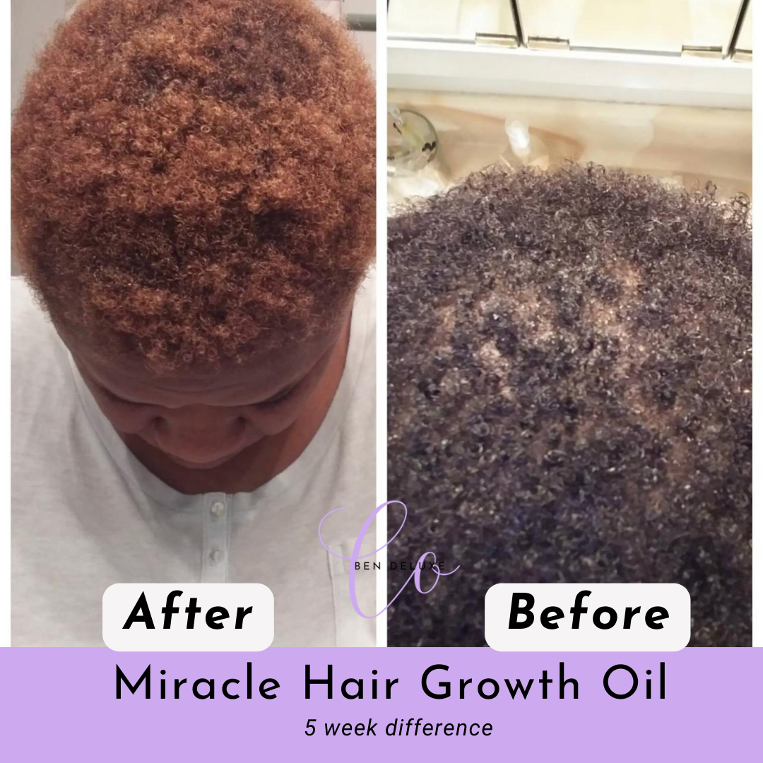 Bendeluxeco™ Raw African Chebe Rosemary oil (Miracle Hair Growth Oil) 💜 BEST SELLER🔥🔥🔥