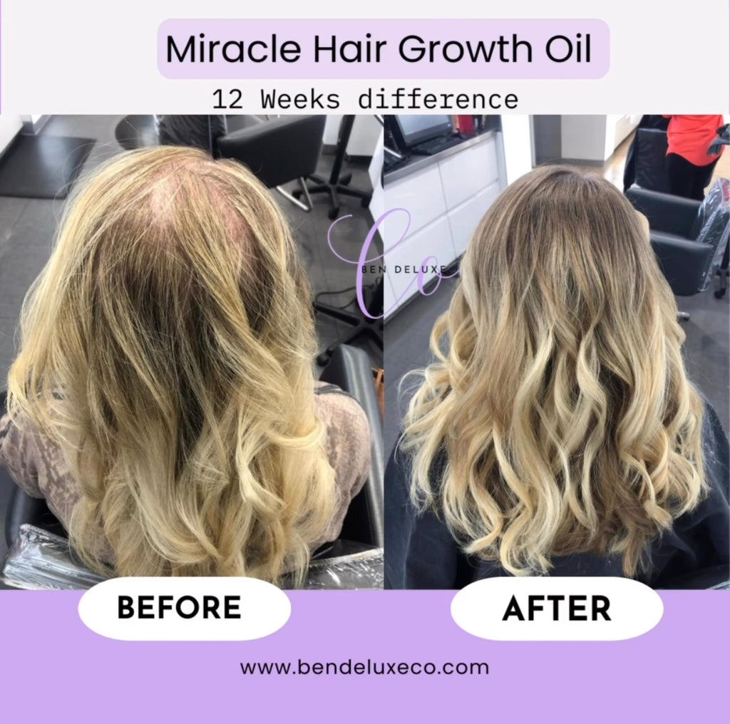 'Raw' African Indian Infused Growth oil 💜 VIRAL + BEST SELLER🔥