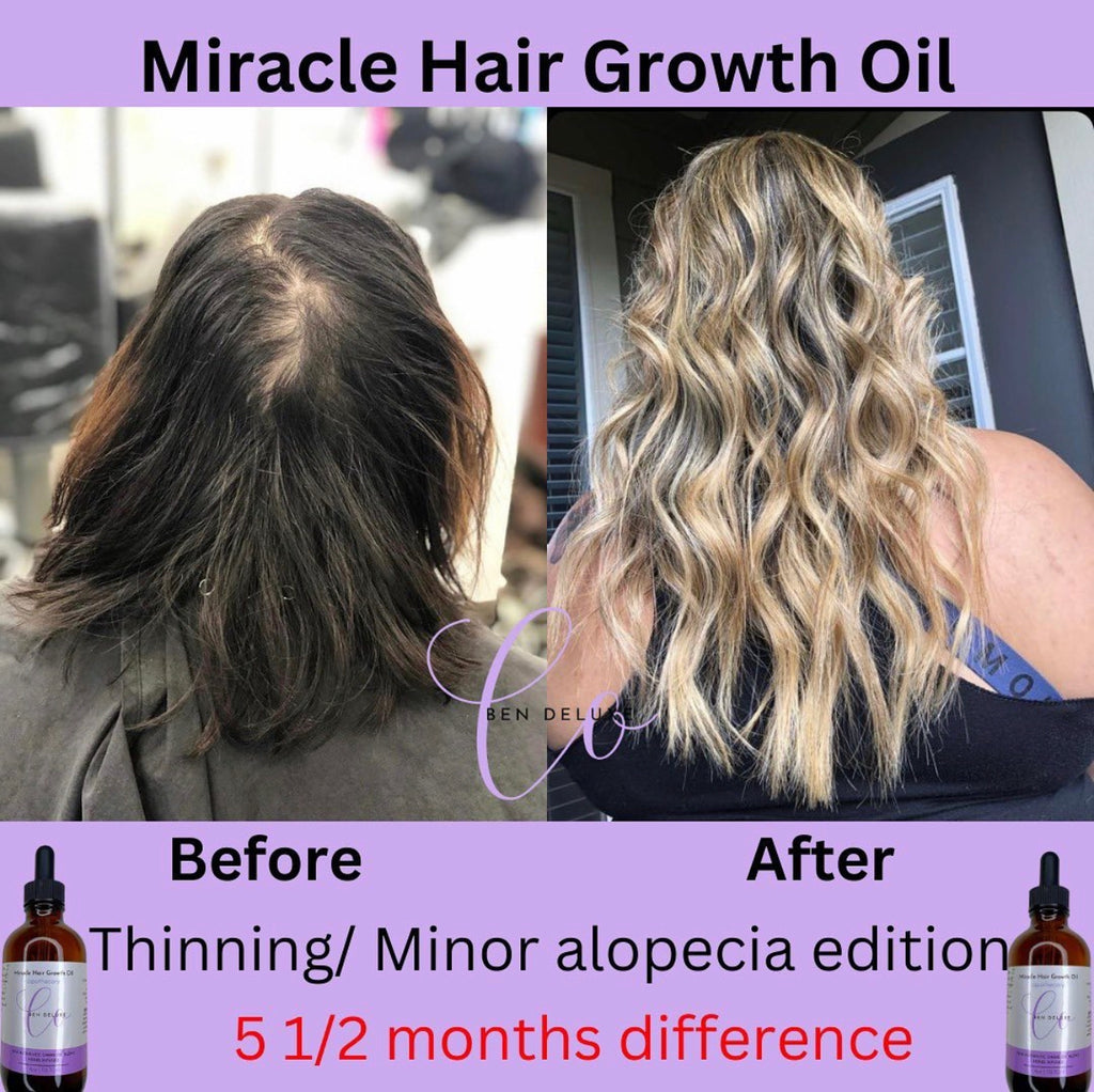 'Raw' African Indian Infused Growth oil 💜 VIRAL + BEST SELLER🔥