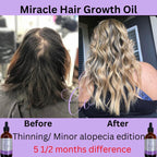 'Raw' African Indian Infused Growth oil 💜 VIRAL + BEST SELLER🔥