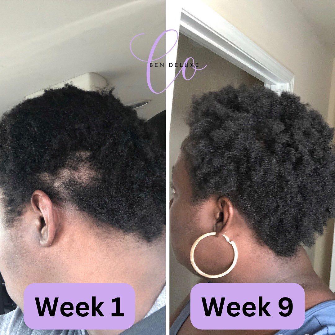 'Raw' African Indian Infused Growth oil 💜 VIRAL + BEST SELLER🔥